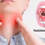 Boğaz Ağrısı (Farenjit) Nedir? Belirtileri, Nedenleri ve Tedavisi